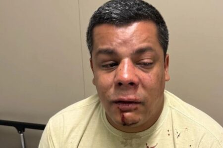 CANDIDATO A VEREADOR ALEGA TER SIDO AGREDIDO POR RODRIGO AMORIM DURANTE CONFUSÃO NA TIJUCA
